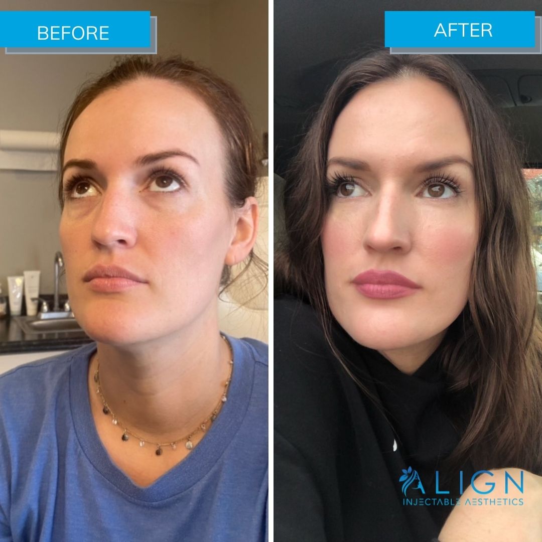 How To Fix Under Eye Bags Home Interior Design